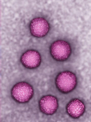 E型肝炎ウイルスの顕微鏡写真