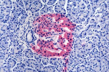膵臓のβ細胞の写真