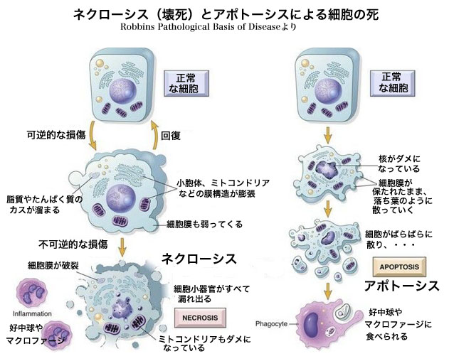 アポトーシスとネクローシスでの細胞の死に方の差異