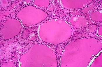 甲状腺細胞の写真