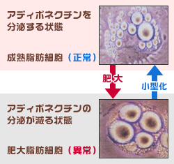 脂肪細胞の大型化によるアデイポネクチン産生低下を示す図