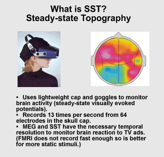定常状態トポグラフィー（SST）の画像写真