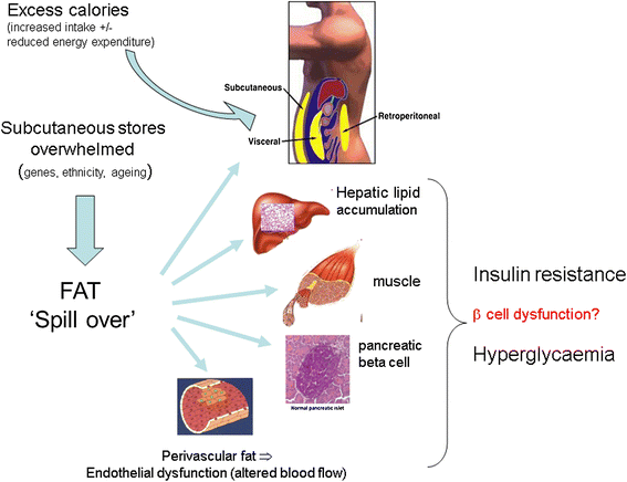 異所性脂肪により各臓器でインスリン抵抗性が誘導される機序を示す図