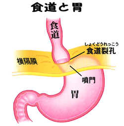 横隔膜の食道裂孔を食道が貫いていることを示す図