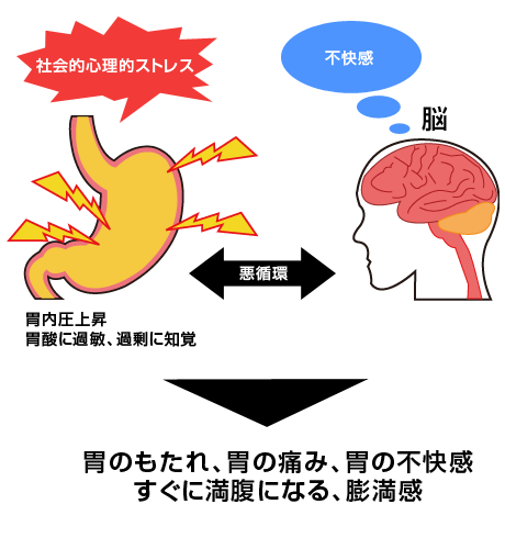 胃の痛みを脳が感じることの説明図