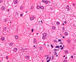 肝細胞の顕微鏡写真