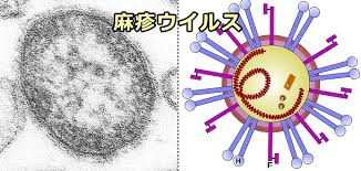 麻疹ウイルスの写真と構造図