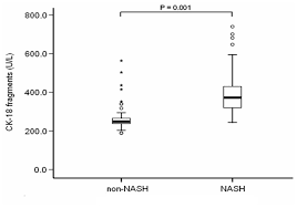NASH　非NASH間でのCK18 fragment値の差を示すグラフ