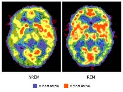 レムとノンレムで活動している脳の部位が異なることを示す図