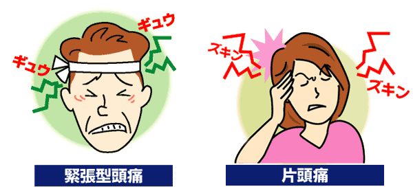 片頭痛　緊張型頭痛の症状