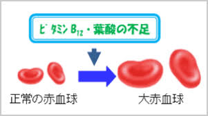 欠乏で巨赤芽球性貧血が生じることを説明した図