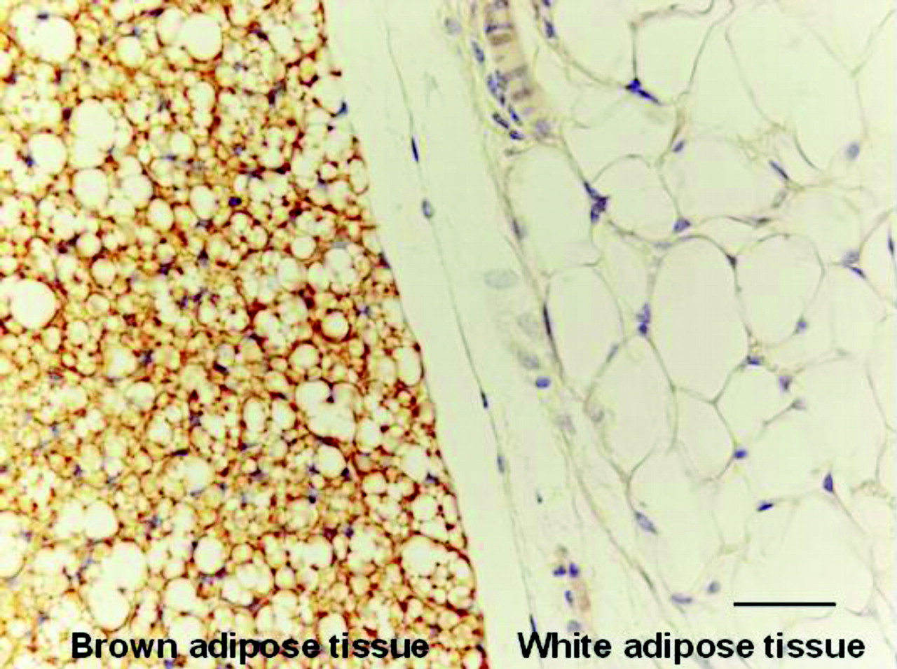 白色脂肪細胞　褐色脂肪細胞の顕微鏡像