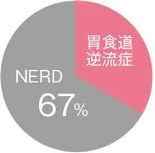 NERDがGERDの60％を占めることを示すグラフ