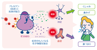 肥満細胞が化学物質（ケミカルメデイエーター）を放出することを示した図