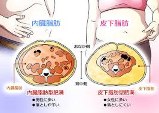 内臓脂肪と皮下脂肪の差異を示したイラスト