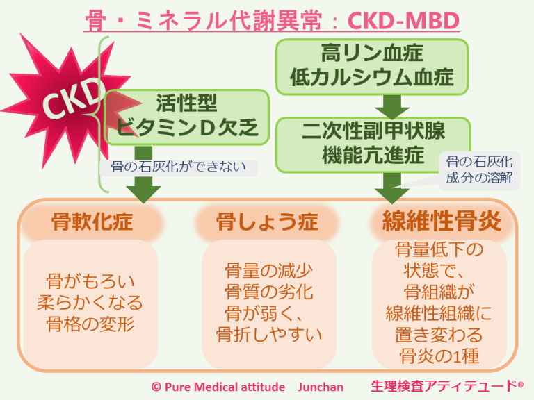 骨粗鬆症のその他の危険因子
