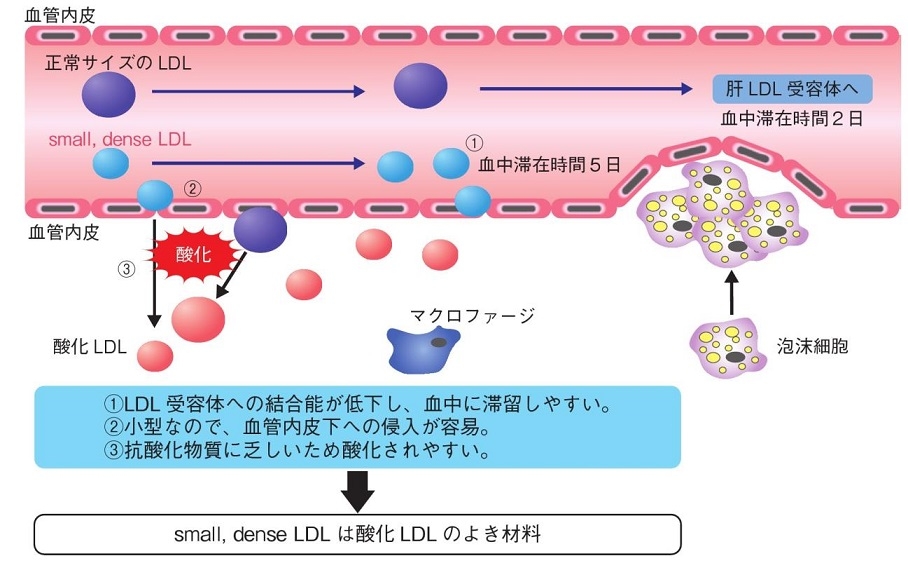 sdLDLが酸化LDL-Cになりやすい理由を説明する図
