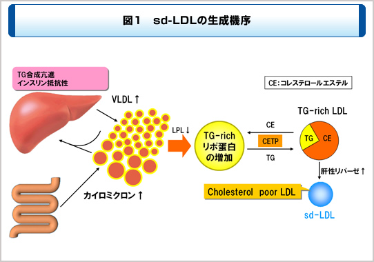 中性脂肪が高いとsdLDLが高くなる機序を説明した図