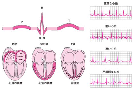 心臓内の興奮の伝わり方と心電図の波形の関連を示した図その２