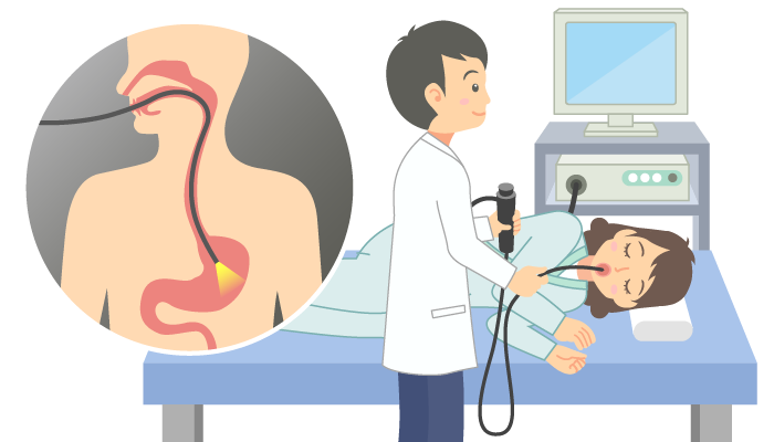 バリウムを飲み込むとどのような症状の診断に役立ちますか?