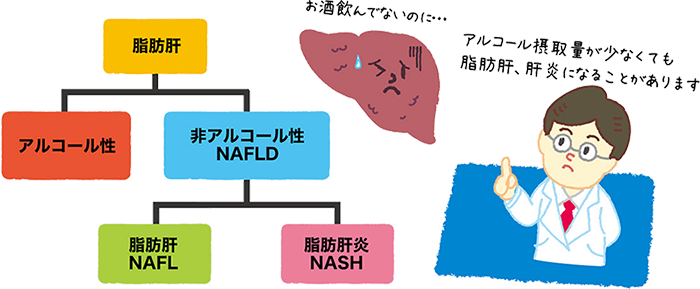 NASHについて説明した図