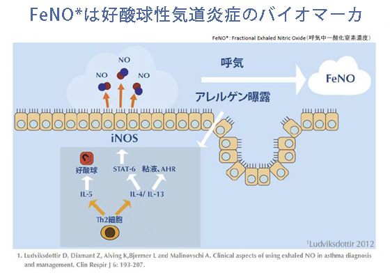 喘息でFeNOが増加する機序を示す図