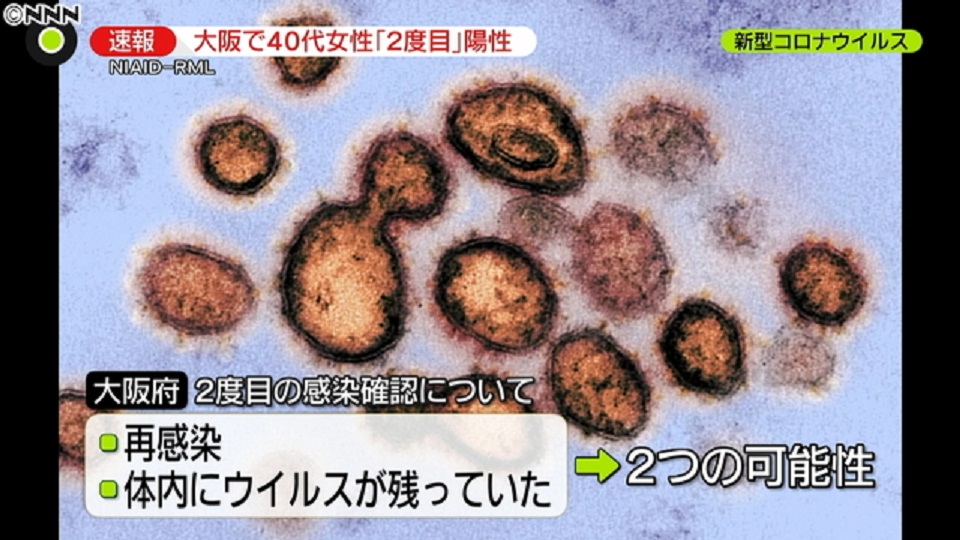 日本での再感染者のニュース