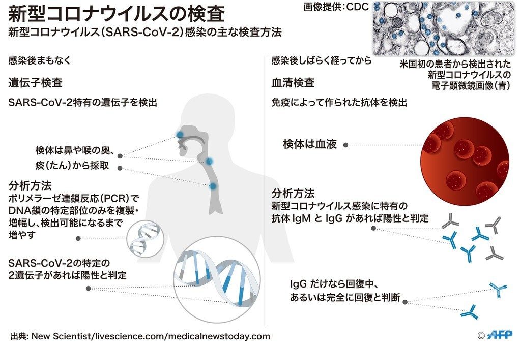 抗体検査の限界と考慮事項