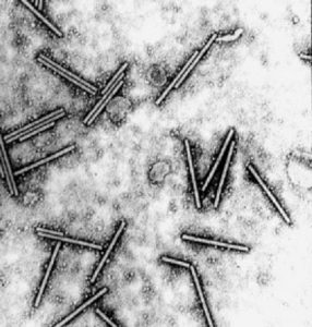 タバコモザイクウイルスの電子顕微鏡写真