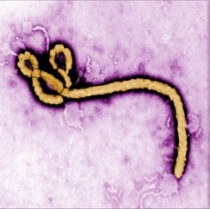 エボラウイルスの写真