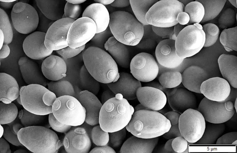酵母の電子顕微鏡写真