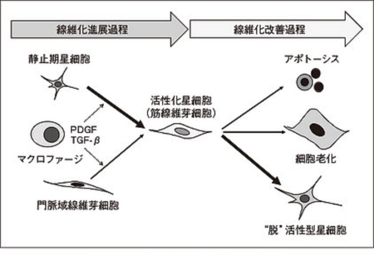線維化の主役 筋線維芽細胞 | 高橋医院