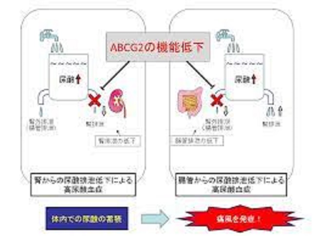 ABCG2の遺伝子変異により腸管での機能低下がみられることを示す図